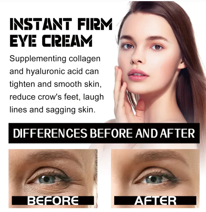 Eye Bag Tightening Cream